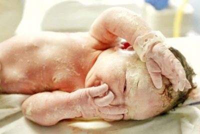 ¿Qué es la capa blanca del bebé?